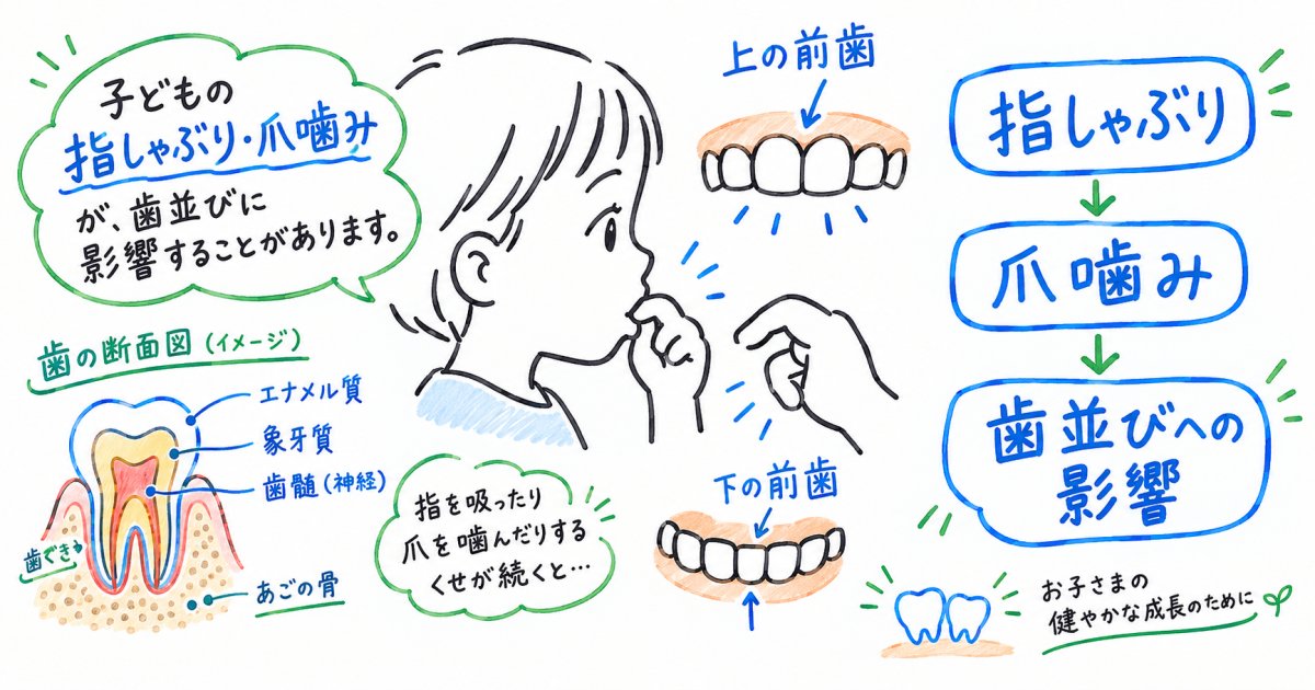 指しゃぶり・爪噛みが歯並びに与える影響とは？歯科医師が解説