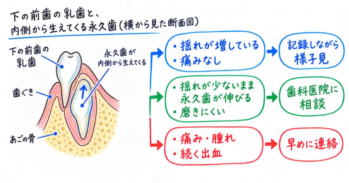 様子見と受診を分ける、乳歯と永久歯の確認点